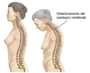 Cervicale